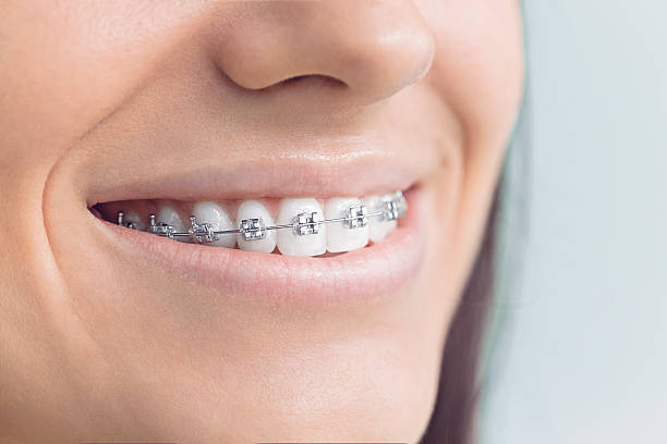 Best Dental Inlays and Onlays  in Daleville, IN